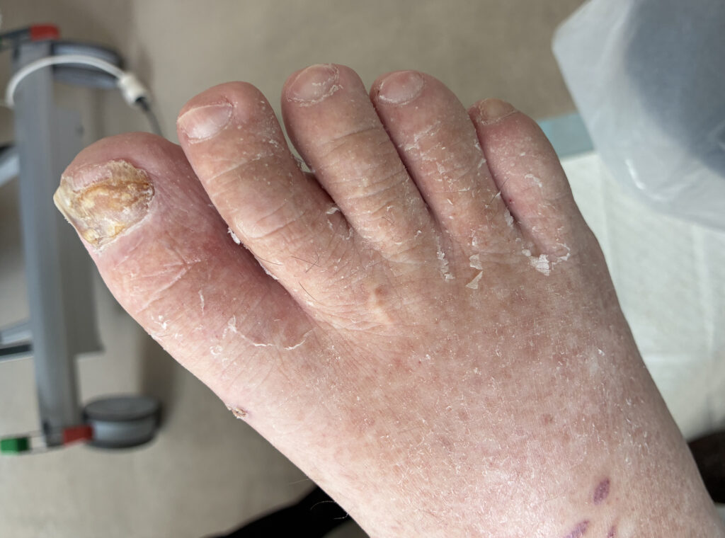 Fußpflege im Unfallkrankenhaus Meidling, Traumazentrum AUVA